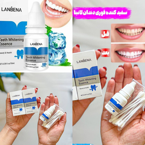 سفید کننده دندان لانبنا