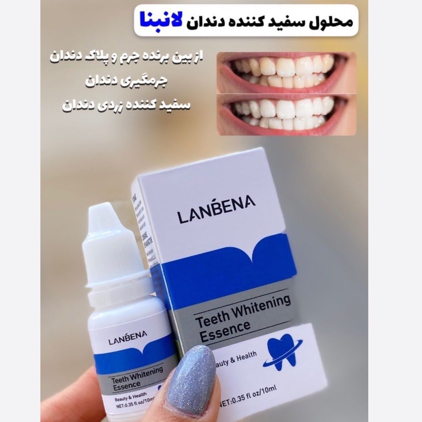 قطره سفید کننده دندان