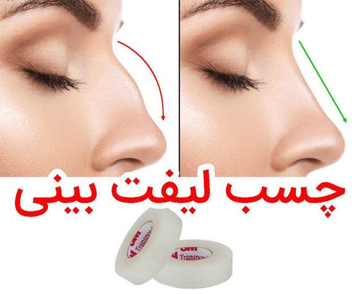 چسپ لیفت بینی