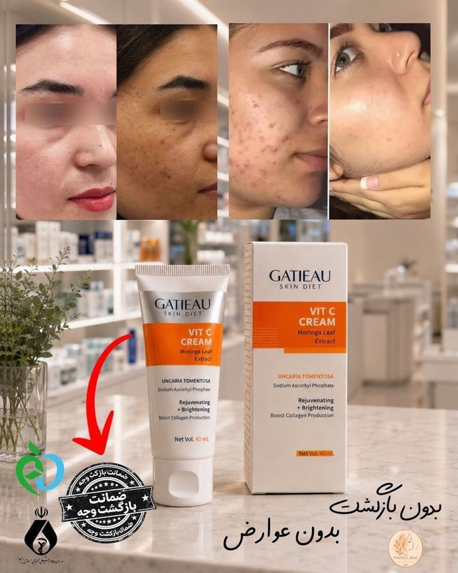 کرم ضد لک بیوممتیک ایتالیایی اصل بشرط بارکد اورجینال آف ویژه تا پنجشنبه